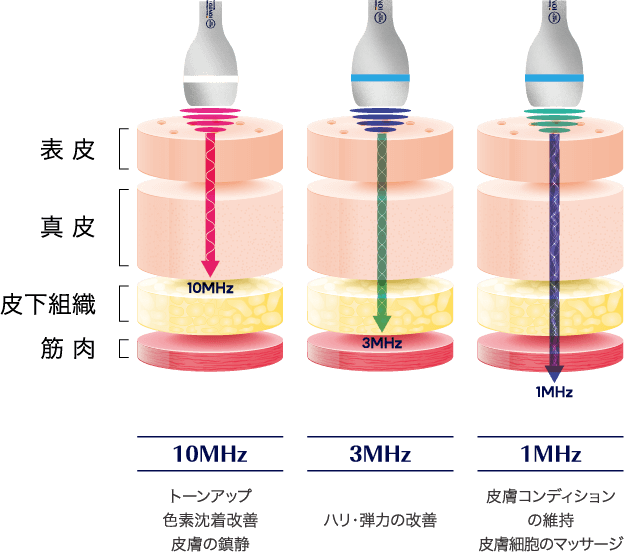 ハンドピースの画像