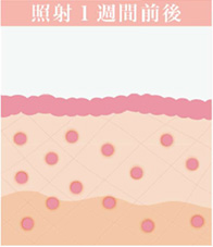 照射1週間前後