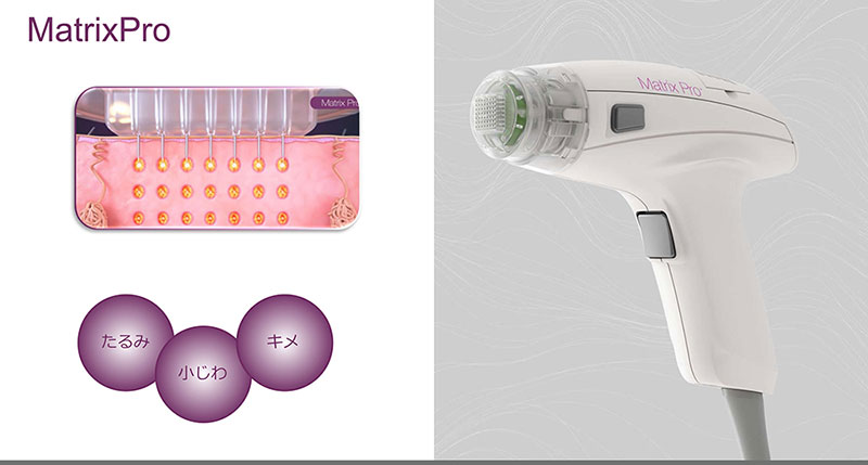 マトリックスプロ③