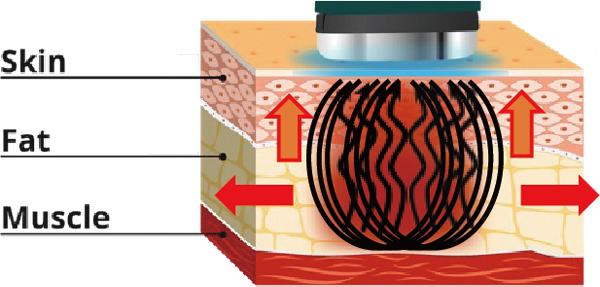 マイクロ波電源 断面